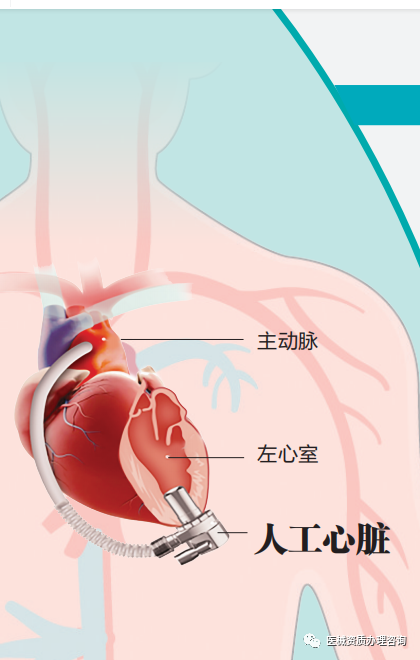 微信图片_20230210143831.png